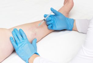 Cập nhật kiến thức về liệu pháp tiêm xơ – BS. Doãn Hữu Linh