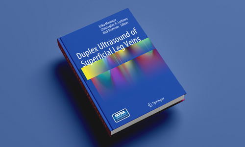 Siêu âm Duplex tĩnh mạch nông chi dưới