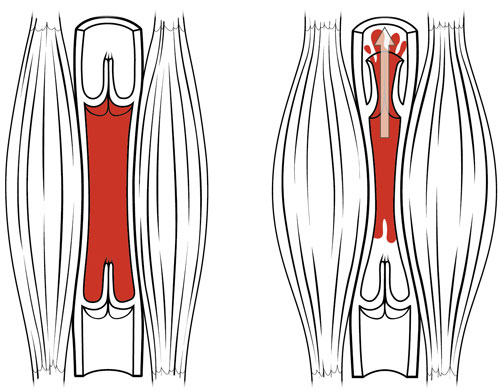 Bơm cơ tĩnh mạch tham gia tích cực vào tuần hoàn tĩnh mạch