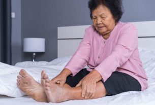 40% người trên 50 tuổi ở Việt Nam mắc suy tĩnh mạch chân mạn tính