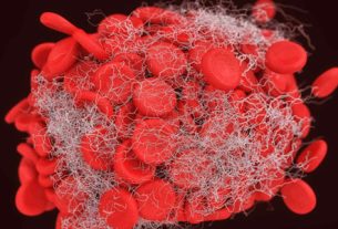 Apixaban liều thấp kéo dài giúp giảm tái phát huyết khối tĩnh mạch ở bệnh nhân có yếu tố nguy cơ mạn tính